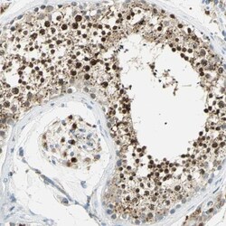 Arylsulfatase A/ARSA Antibody, Novus Biologicals 0.1mL; Unlabeled:Antibodies,