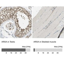 Arylsulfatase A/ARSA Antibody, Novus Biologicals 0.1mL; Unlabeled:Antibodies,