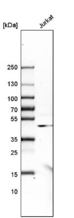 Arylsulfatase A/ARSA Antibody, Novus Biologicals 0.1mL; Unlabeled:Antibodies,
