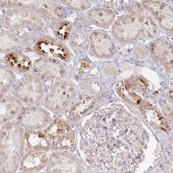 Arylsulfatase B/ARSB Antibody, Novus Biologicals 0.1mL; Unlabeled:Antibodies,