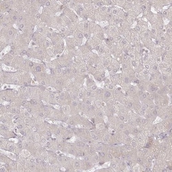 Arylsulfatase B/ARSB Antibody, Novus Biologicals 0.1mL; Unlabeled:Antibodies,