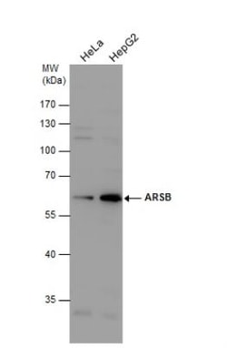 Arylsulfatase B/ARSB Antibody, Novus Biologicals 0.1mL; Unlabeled:Antibodies,