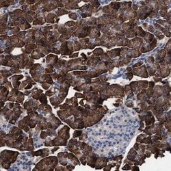 Arylsulfatase G/ARSG Antibody, Novus Biologicals:Antibodies:Primary Antibodies