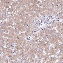 Asialoglycoprotein Receptor 2 Antibody, Novus Biologicals 0.1mL; Unlabeled:Antibodies