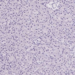 Asialoglycoprotein Receptor 2 Antibody, Novus Biologicals 0.1mL; Unlabeled:Antibodies,