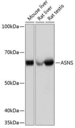 Asparagine synthetase Rabbit anti-Human, Mouse, Rat, Clone: 7M10Z7, Novus