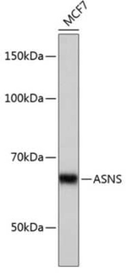 Asparagine synthetase Rabbit anti-Human, Mouse, Rat, Clone: 7M10Z7, Novus