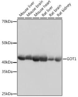 Aspartate Aminotransferase Rabbit anti-Human, Mouse, Rat, Clone: 5J1B4,