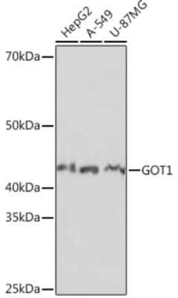 Aspartate Aminotransferase Rabbit anti-Human, Mouse, Rat, Clone: 5J1B4,