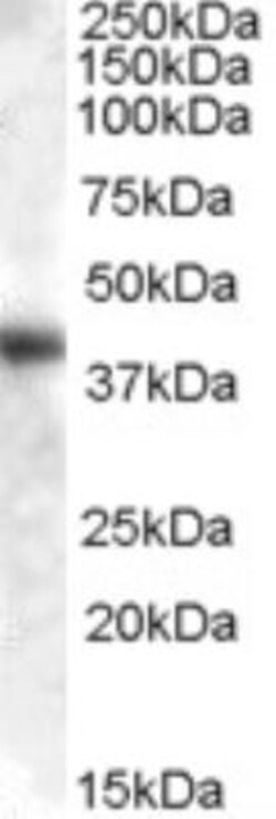 Aspartate Aminotransferase Antibody, Novus Biologicals 0.1mg; Unlabeled:Antibodies,