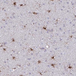 Aspartate beta hydroxylase Antibody, Novus Biologicals:Antibodies:Primary