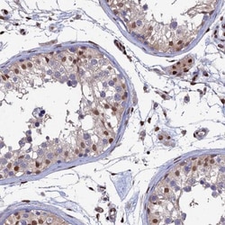 Aspartyl Aminopeptidase Antibody, Novus Biologicals:Antibodies:Primary