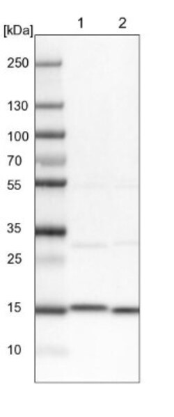 Aspartyl Aminopeptidase Antibody, Novus Biologicals 25 &mu;L; Unlabeled:Antibodies,