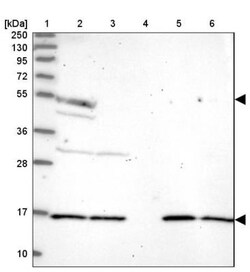 Aspartyl Aminopeptidase Antibody, Novus Biologicals 25 &mu;L; Unlabeled:Antibodies,