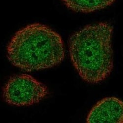 Atad5 Rabbit anti-Human, Polyclonal, Novus Biologicals 25 &mu;g; Unconjugated:Antibodies,