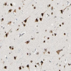 Ataxin 1 Antibody, Novus Biologicals:Antibodies:Primary Antibodies