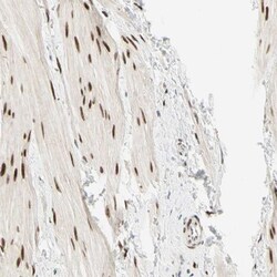 Ataxin 1 Antibody, Novus Biologicals:Antibodies:Primary Antibodies