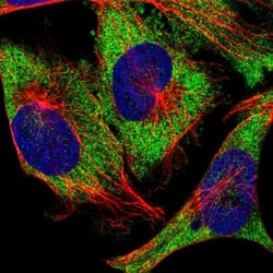 Ataxin-2 Antibody, Novus Biologicals:Antibodies:Primary Antibodies