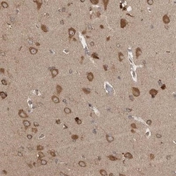 Ataxin-2 Antibody, Novus Biologicals 0.1mL; Unlabeled:Antibodies, Polyclonal