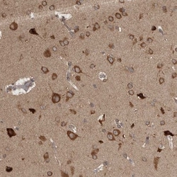 Ataxin-2 Antibody, Novus Biologicals 0.1mL; Unlabeled:Antibodies, Polyclonal