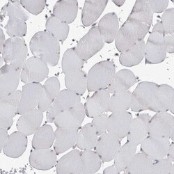 Ataxin-2 Antibody, Novus Biologicals:Antibodies:Primary Antibodies