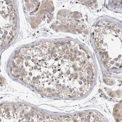 Ataxin-2 Antibody, Novus Biologicals:Antibodies:Primary Antibodies