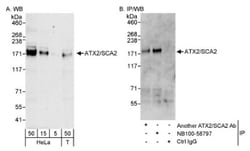 Ataxin-2 Antibody, Novus Biologicals 0.1mL; Unlabeled:Antibodies