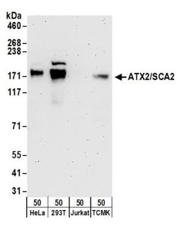 Ataxin-2 Antibody, Novus Biologicals 0.1mL; Unlabeled:Antibodies