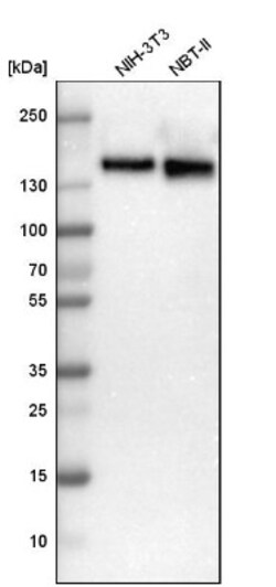 Ataxin-2 Antibody, Novus Biologicals:Antibodies:Primary Antibodies