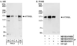 Ataxin-2-like protein Antibody, Novus Biologicals 0.1 mL | Buy Online | Novus Biologicals | Fisher Scientific