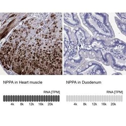 Atrial Natriuretic Peptide/ANP Rabbit anti-Human, Polyclonal, Novus Biologicals:Antikörper:Primärantikörper