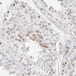 Aurora A Antibody, Novus Biologicals 25 &mu;L | Buy Online | Novus Biologicals | Fisher Scientific