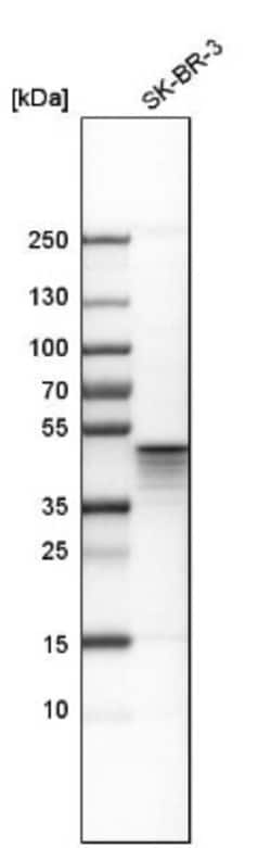 Aurora A Antibody, Novus Biologicals 25 &mu;L | Buy Online | Novus Biologicals | Fisher Scientific