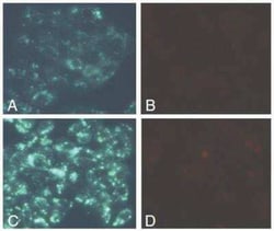 Novus Biologicals&trade;&nbsp;Autophagy/Cytotoxicity Dual Staining Kit