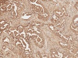 Axin-2 Antibody, Novus Biologicals 100 &mu;g | Buy Online | Novus Biologicals | Fisher Scientific