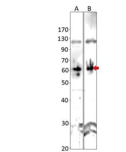 Axin-2 Antibody, Novus Biologicals 100 &mu;g; Unconjugated:Antibodies,