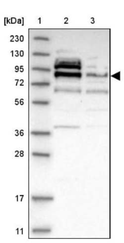 Axotrophin Antibody, Novus Biologicals 25 &mu;L | Buy Online | Novus Biologicals | Fisher Scientific