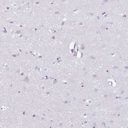 Azurocidin/CAP37/HBP Antibody, Novus Biologicals 0.1mL; Unlabeled:Antibodies,
