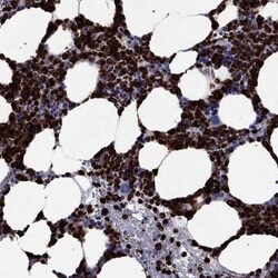 Azurocidin/CAP37/HBP Rabbit anti-Human, Polyclonal, Novus Biologicals 100