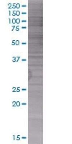 Novus Biologicals Azurocidin/CAP37/HBP 293T Cell Transient Overexpression Lysate 0.1 mL | Buy Online | Novus Biologicals&trade; | Fisher Scientific