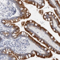 B3GNT3 Antibody, Novus Biologicals:Antibodies:Primary Antibodies