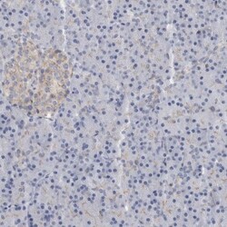 B3GNT3 Antibody, Novus Biologicals:Antibodies:Primary Antibodies