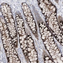 B3GNT7 Antibody, Novus Biologicals:Antibodies:Primary Antibodies