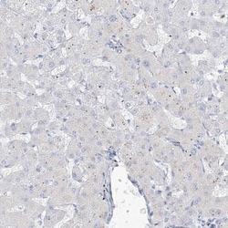 B3GNT7 Antibody, Novus Biologicals:Antibodies:Primary Antibodies