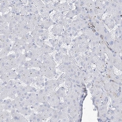 B3GNT7 Antibody, Novus Biologicals 0.1mL; Unlabeled:Antibodies, Polyclonal