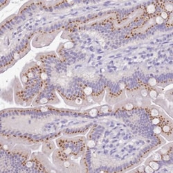 B3GNT8 Antibody, Novus Biologicals 0.1mL; Unlabeled:Antibodies, Polyclonal
