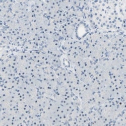 B4GALNT1 Antibody, Novus Biologicals:Antibodies:Primary Antibodies