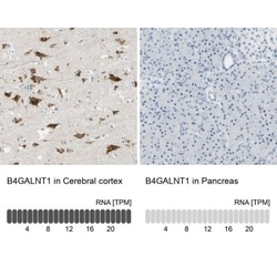B4GALNT1 Antibody, Novus Biologicals:Antibodies:Primary Antibodies
