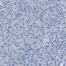 B4GALNT1 Antibody, Novus Biologicals 0.1mL; Unlabeled:Antibodies, Polyclonal