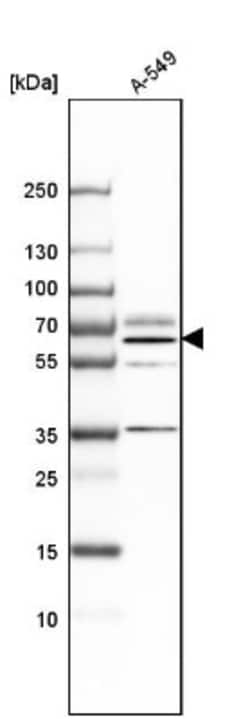 B4GALNT1 Antibody, Novus Biologicals:Antibodies:Primary Antibodies